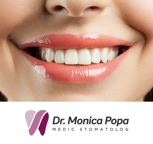 Dr. Monica Popa - Medic stomatolog